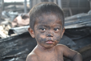 One little boy who lives in the community covered in Ash. 