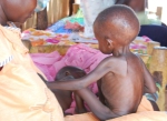 Thousands of Children are battling Malnutrition in the Sudan.