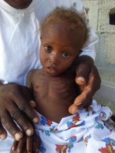 Thank You For Helping Children Like This Baby Girl Find The Help She Needs to Stay Alive! 